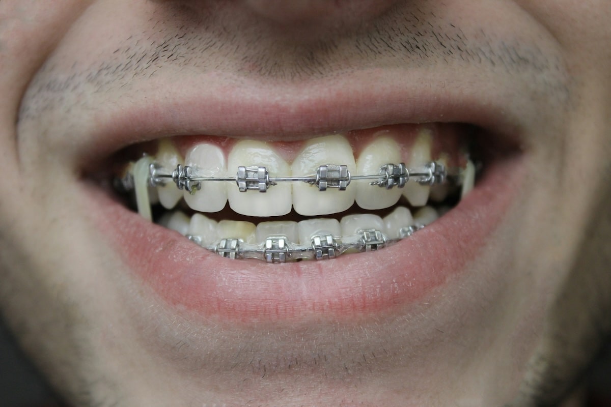 Combien gagne un orthodontiste ?